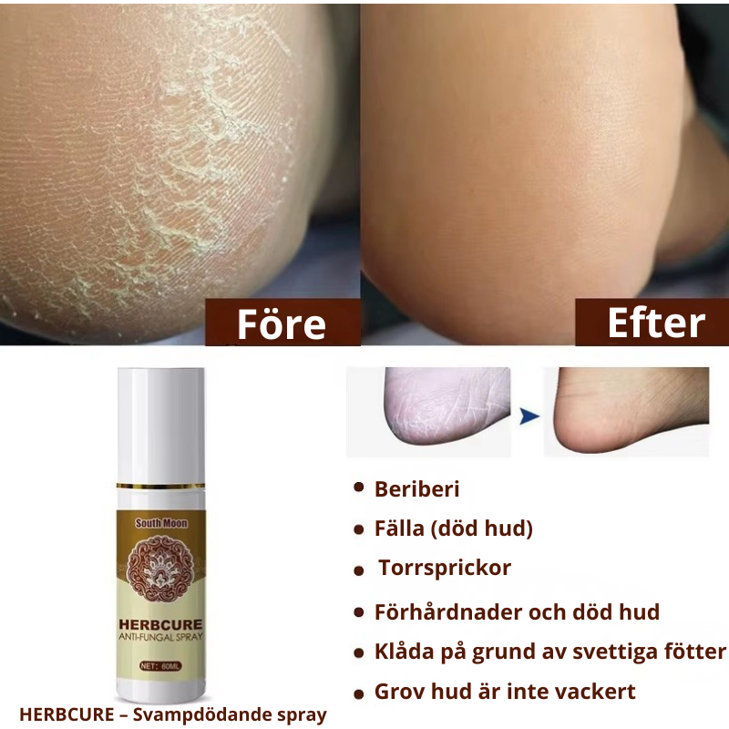 60 ml Svampspray för fötter, fotsteriliserande spray